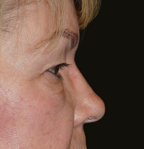 Plastic & Reconstructive Surgeons in Renton & Maple Valley